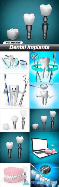 Dental implants - 10 UHQ JPEG