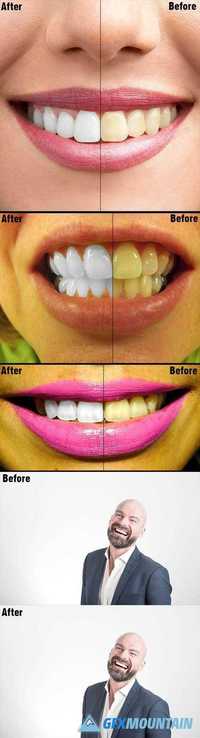 Teeth Whitening PS Action Photo Effects 20347431