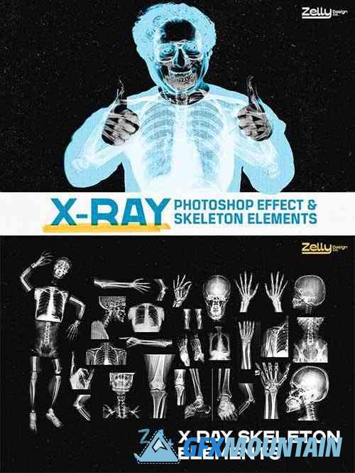 X-Ray Photo Effect & Elements 6219667